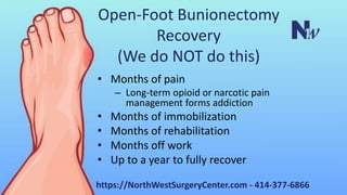 Open-Foot Bunionectomy
Recovery
(We do NOT do this)
• Months of pain
– Long-term opioid or narcotic pain
management forms ...