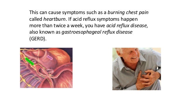 How to treat Acid Reflux and prevent heartburn and chest ...