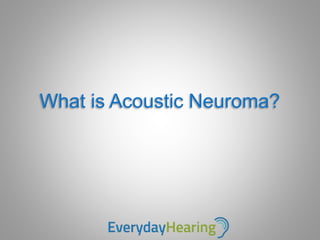 What is Acoustic Neuroma?
 