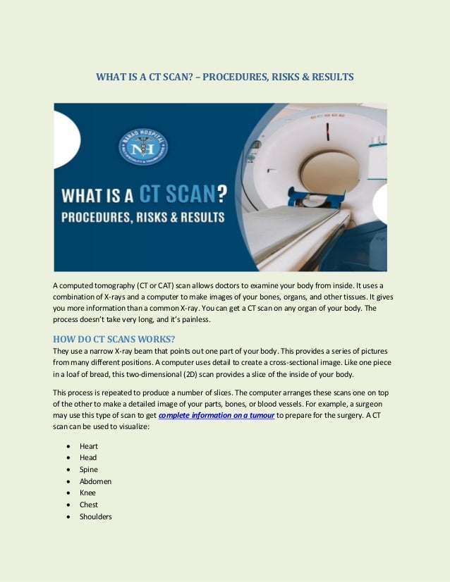 What is a CT Scan? Procedures, Risks & Results