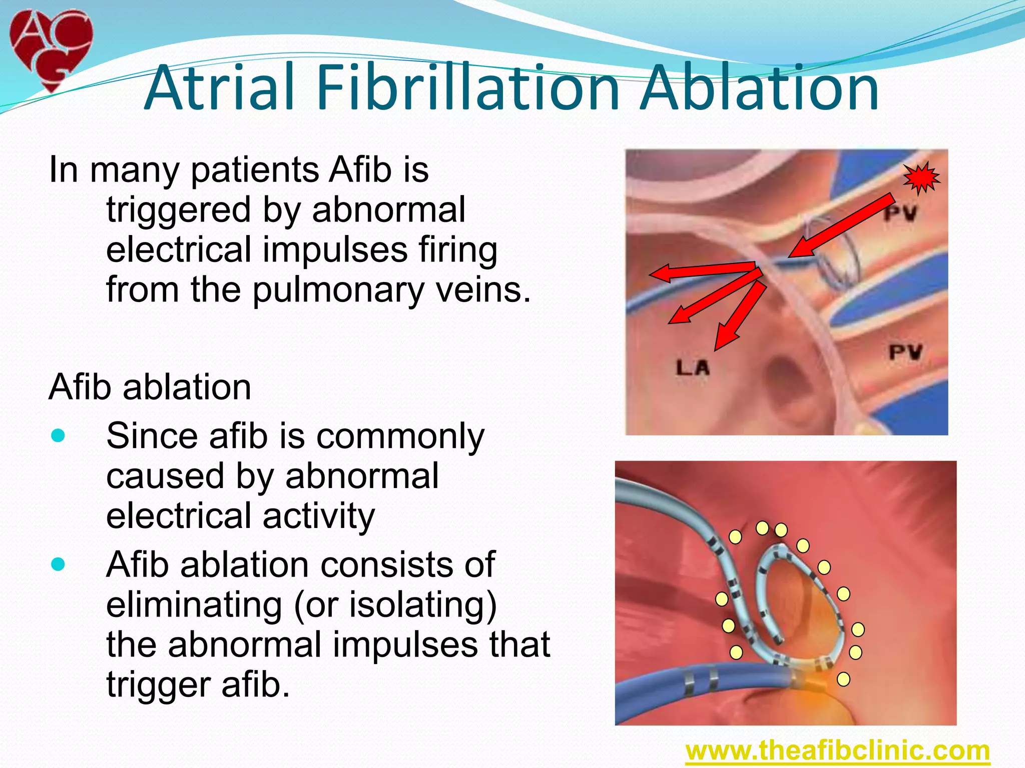 In many patients Afib is
triggered by abnormal
electrical impulses firing
from the pulmonary veins.
Afib ablation
 Since afib is commonly
caused by abnormal
electrical activity
 Afib ablation consists of
eliminating (or isolating)
the abnormal impulses that
trigger afib.
Atrial Fibrillation Ablation
www.theafibclinic.com
 