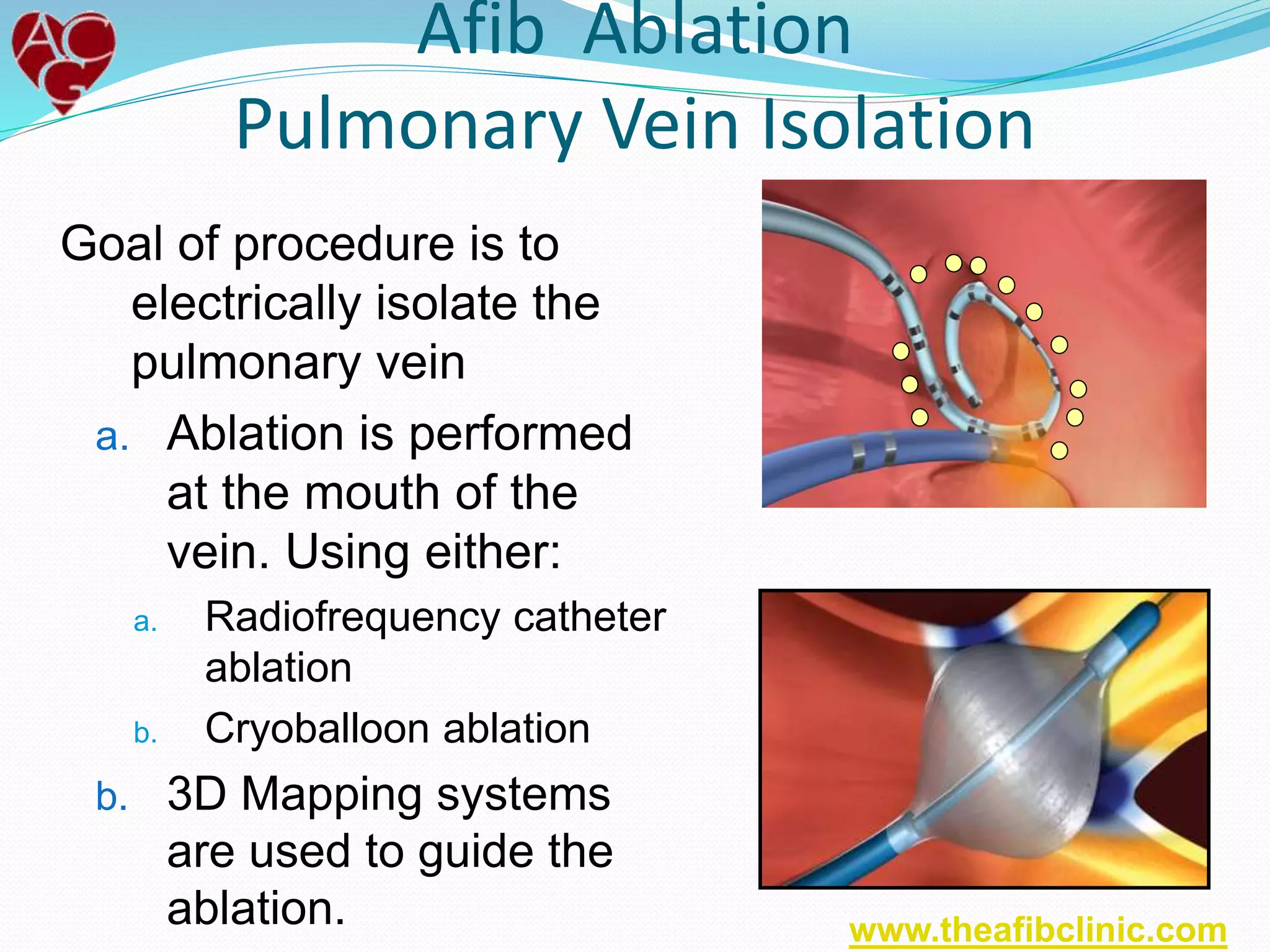 Goal of procedure is to
electrically isolate the
pulmonary vein
a. Ablation is performed
at the mouth of the
vein. Using either:
a. Radiofrequency catheter
ablation
b. Cryoballoon ablation
b. 3D Mapping systems
are used to guide the
ablation.
Afib Ablation
Pulmonary Vein Isolation
www.theafibclinic.com
 