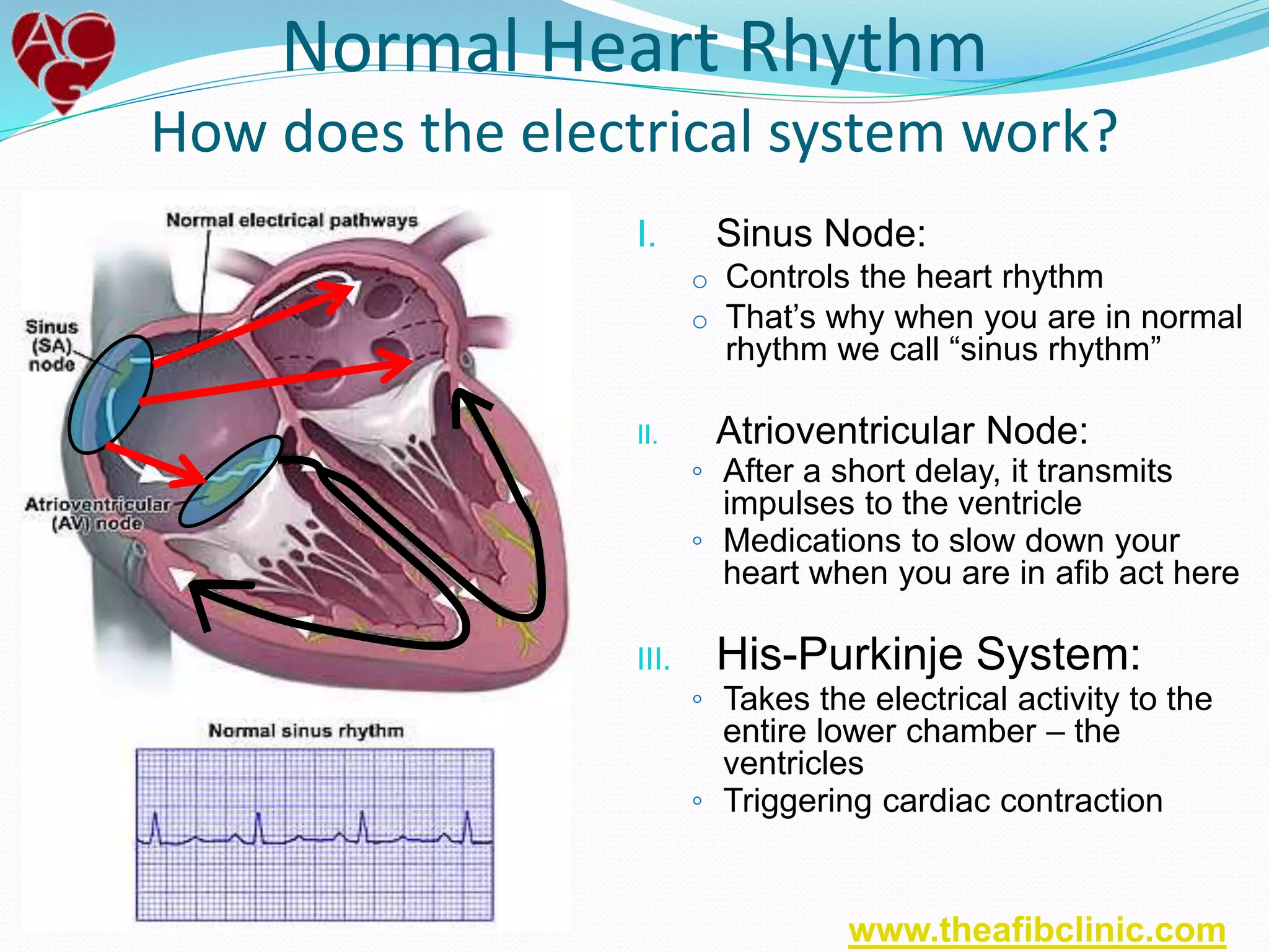 Normal Heart Rhythm
How does the electrical system work?
I. Sinus Node:
o Controls the heart rhythm
o That’s why when you are in normal
rhythm we call “sinus rhythm”
II. Atrioventricular Node:
◦ After a short delay, it transmits
impulses to the ventricle
◦ Medications to slow down your
heart when you are in afib act here
III. His-Purkinje System:
◦ Takes the electrical activity to the
entire lower chamber – the
ventricles
◦ Triggering cardiac contraction
www.theafibclinic.com
 
