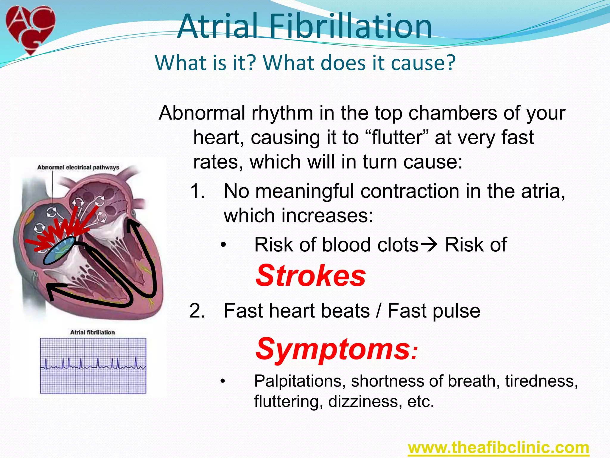 Atrial Fibrillation
What is it? What does it cause?
Abnormal rhythm in the top chambers of your
heart, causing it to “flutter” at very fast
rates, which will in turn cause:
1. No meaningful contraction in the atria,
which increases:
• Risk of blood clots Risk of
Strokes
2. Fast heart beats / Fast pulse
Symptoms:
• Palpitations, shortness of breath, tiredness,
fluttering, dizziness, etc.
www.theafibclinic.com
 