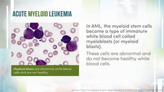 Acute Myeloid Leukemia (AML): Cancer of the Blood & Bone Marrow | PDF