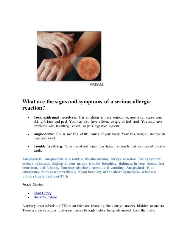 What is an antibiotic medication allergy