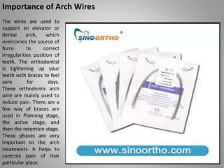 Importance of Arch Wires
The wires are used to
support an elevator or
dental arch, which
overcomes the source of
force to ...