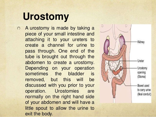 what is an ostomy