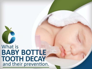 What is Baby Bottle Tooth Decay and their prevention.