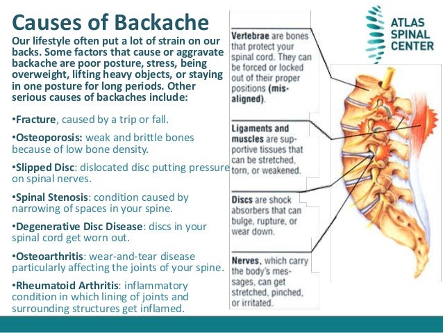 What Is Backache what-is-backache