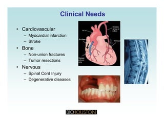 Clinical NeedsClinical Needs
• Cardiovascular
– Myocardial infarction
– Stroke
• Bone
– Non-union fracturesNon union fractures
– Tumor resections
• Nervous
– Spinal Cord Injury
– Degenerative diseases
 