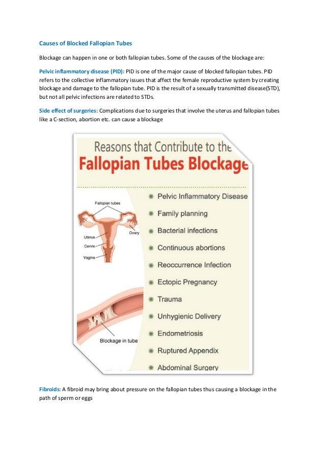 What is blocked fallopian tubes?