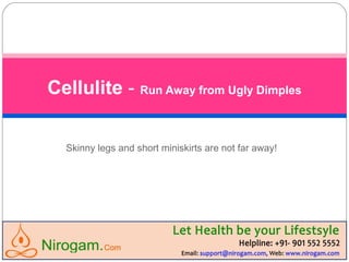 Skinny legs and short miniskirts are not far away!
Cellulite - Run Away from Ugly Dimples
Web: www.nirogam.com
Help line: +91-9015525552
Email: support@nirogam.com
 