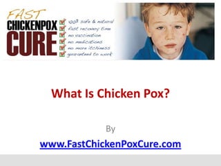 What Is Chicken Pox?

            By
www.FastChickenPoxCure.com
 