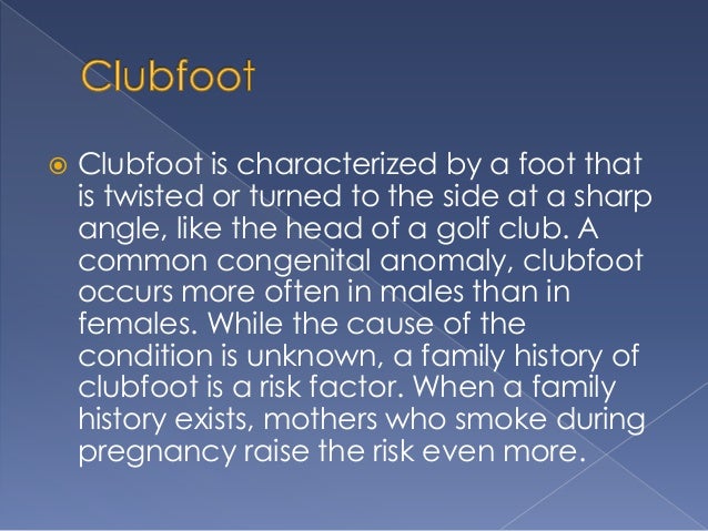 What Is Clubfoot