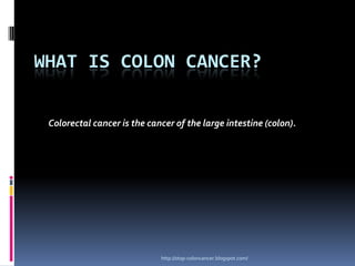 What is colon cancer? Colorectal cancer is the cancer of the large intestine (colon).  http://stop-coloncancer.blogspot.com/ 