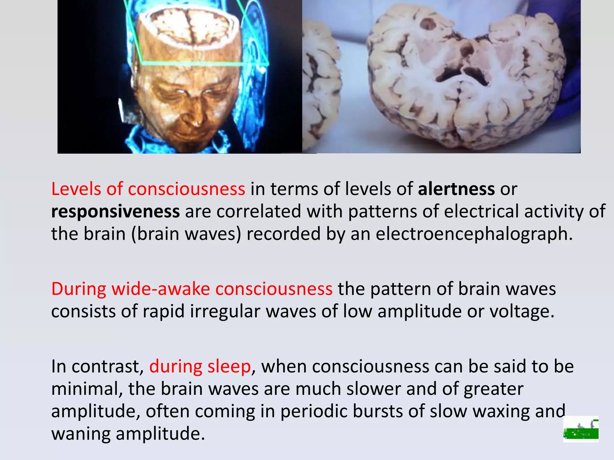 Levels of consciousness  in terms of levels of  alertness  or  responsiveness  are correlated with patterns of electrical activity of the brain (brain waves) recorded by an electroencephalograph.  During wide-awake consciousness  the pattern of brain waves consists of rapid irregular waves of low amplitude or voltage. In contrast,  during sleep , when consciousness can be said to be minimal, the brain waves are much slower and of greater amplitude, often coming in periodic bursts of slow waxing and waning amplitude. 