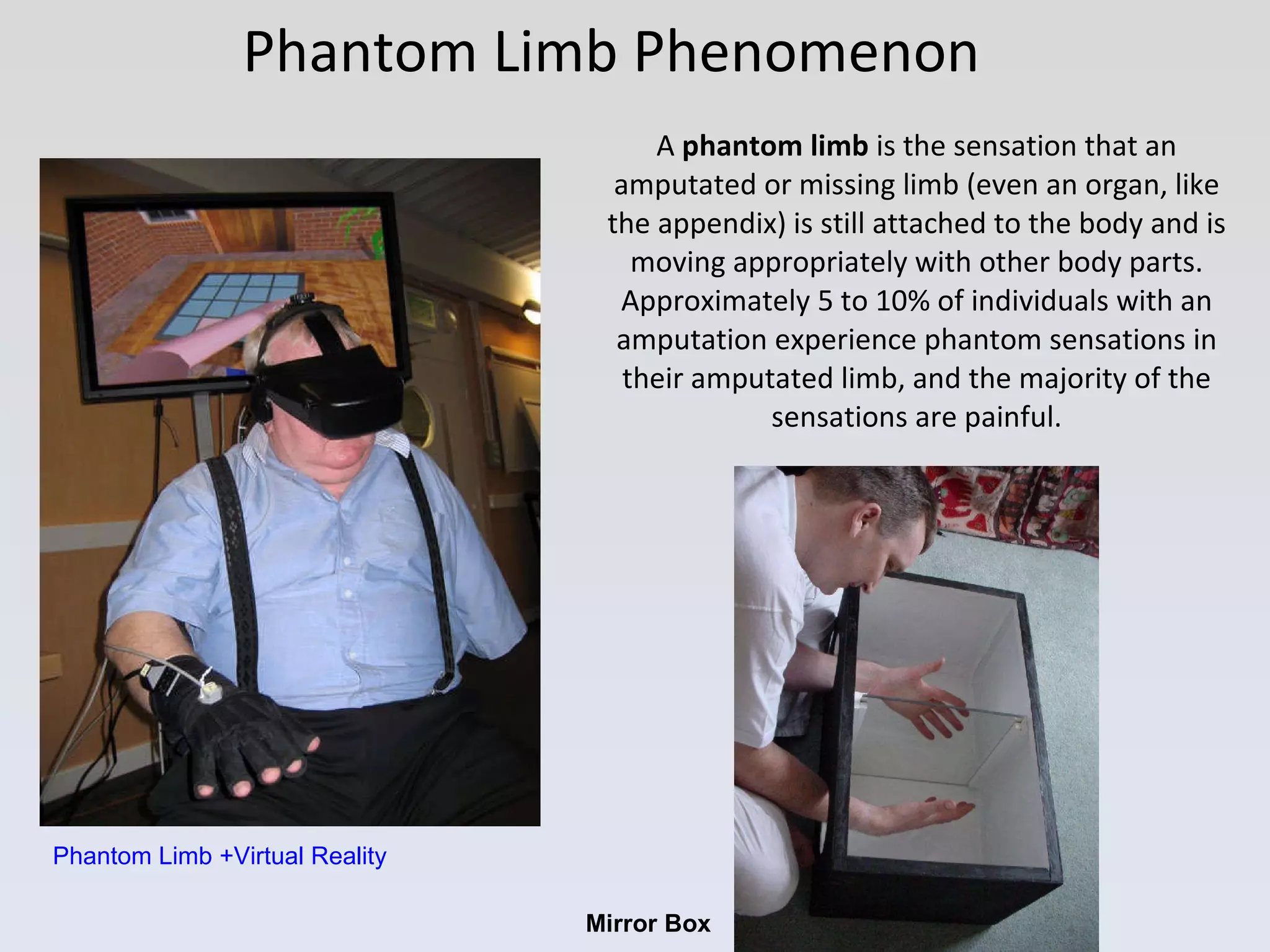 Phantom Limb Phenomenon A  phantom limb  is the sensation that an amputated or missing limb (even an organ, like the appendix) is still attached to the body and is moving appropriately with other body parts. Approximately 5 to 10% of individuals with an amputation experience phantom sensations in their amputated limb, and the majority of the sensations are painful. Mirror Box Phantom Limb +Virtual Reality 