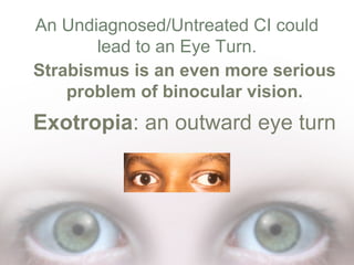 Outward Vision What is Convergence Insufficiency? | PPT