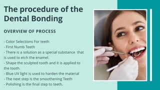 What is dental bonding? | PPTX
