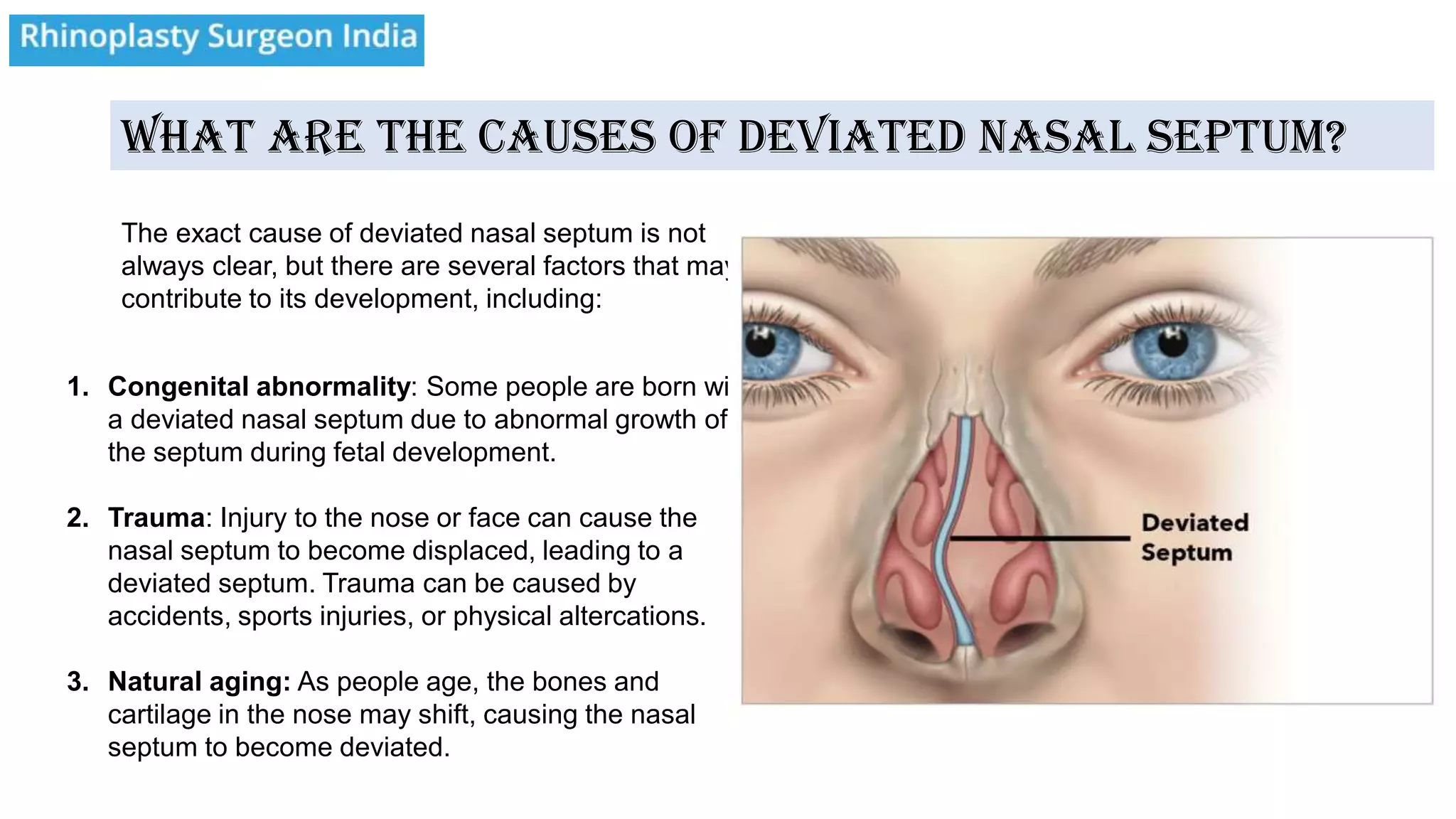 Complex Deviated Septum What is Deviated Nasal Septum | PDF