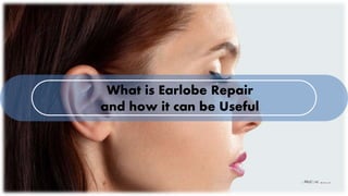 What is Earlobe Repair
and how it can be Useful
 