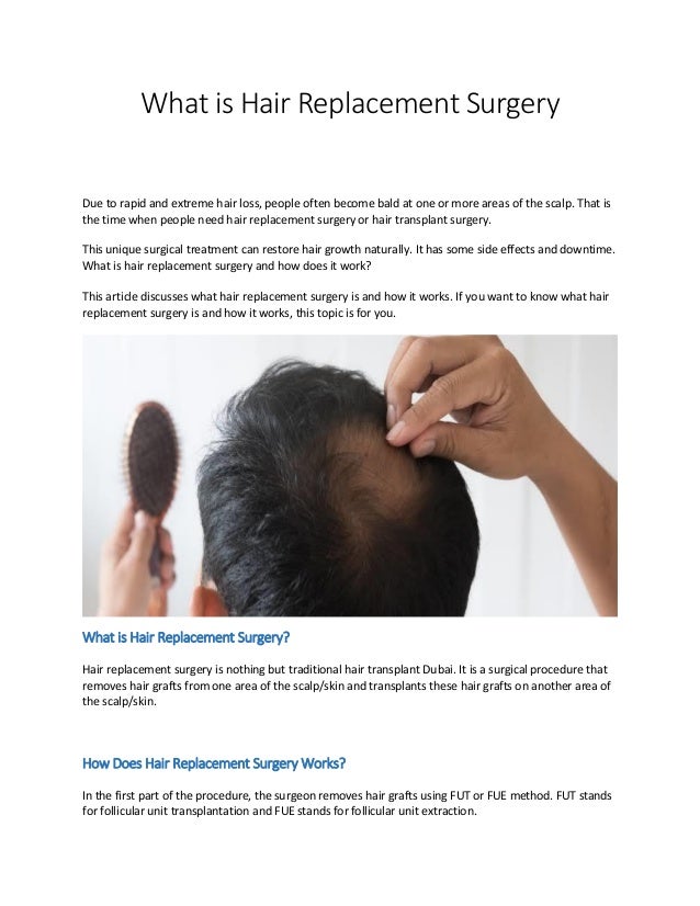 What is hair replacement surgery