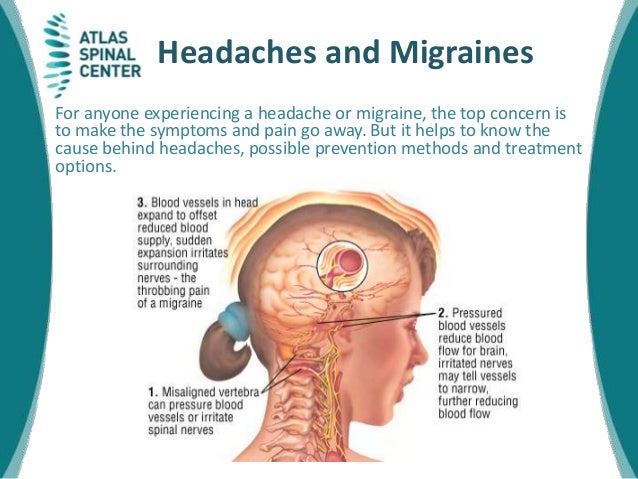 home headache test snl