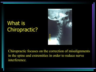 What is Chiropractic?   Chiropractic focuses on the correction of misalignments in the spine and extremities in order to reduce nerve interference. 