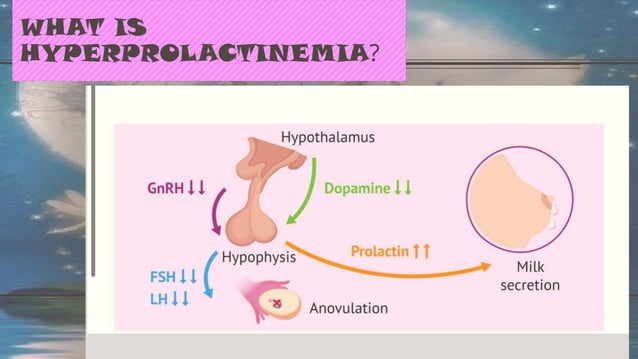 Nonpuerperal Hyperprolactinemia And Nonpuerperal Mastitis . – ASWV