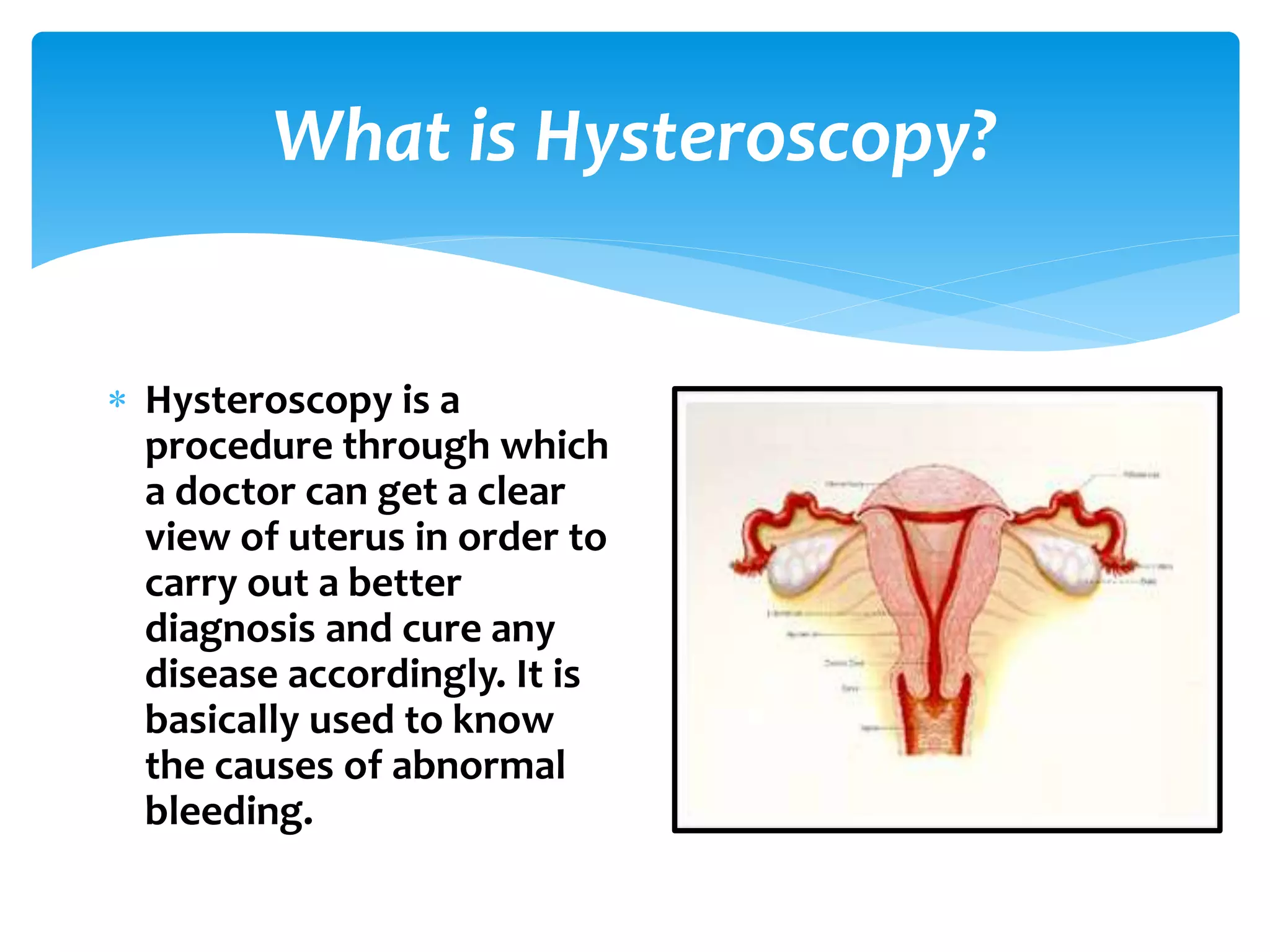 What is Hysteroscopy?
Hysteroscopy is a
procedure through which
a doctor can get a clear
view of uterus in order to
carry out a better
diagnosis and cure any
disease accordingly. It is
basically used to know
the causes of abnormal
bleeding.