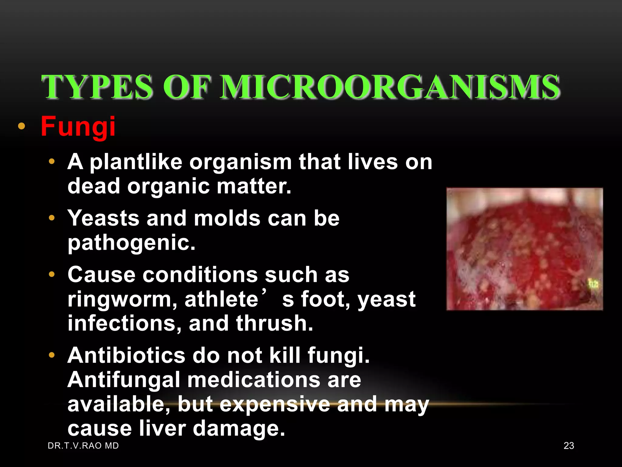 TYPES OF MICROORGANISMS
• Fungi
  • A plantlike organism that lives on
    dead organic matter.
  • Yeasts and molds can be
    pathogenic.
  • Cause conditions such as
    ringworm, athlete’s foot, yeast
    infections, and thrush.
  • Antibiotics do not kill fungi.
    Antifungal medications are
    available, but expensive and may
    cause liver damage.
  DR.T.V.RAO MD                          23
 