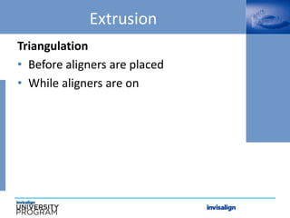 Extrusion
Triangulation
• Before aligners are placed
• While aligners are on
 
