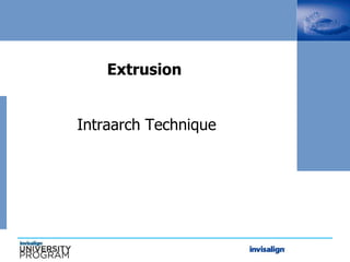 Extrusion
Intraarch Technique
Intraa Technique
 