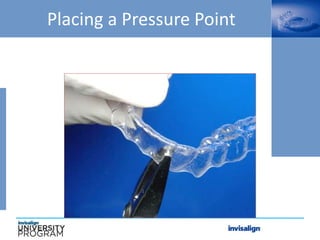 Placing a Pressure Point
 