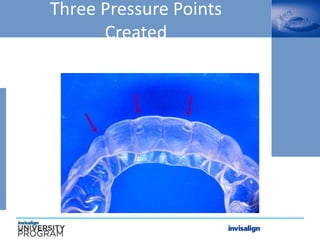 Three Pressure Points
Created
 