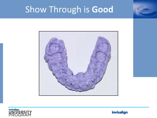 Show Through is Good
 