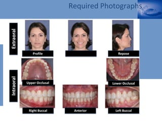 Profile Repose
Lower Occlusal
Left Buccal
Upper Occlusal
Right Buccal Anterior
Extraoral
Intraoral
Required Photographs
 