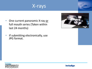 X-rays
• One current panoramic X-ray or
full mouth series (Taken within
last 24 months)
• If submitting electronically, use
JPG format.
 