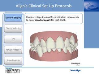 Cases are staged to enable combination movements
to occur simultaneously for each tooth
Align's Clinical Set Up Protocols
General Staging
Tooth Velocity
IPR
Power Ridges™
Attachments
 