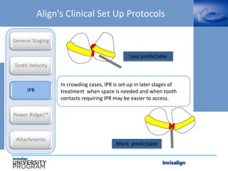 In crowding cases, IPR is set-up in later stages of
treatment when space is needed and when tooth
contacts requiring IPR may be easier to access.
Align's Clinical Set Up Protocols
General Staging
Tooth Velocity
IPR
Power Ridges™
Attachments
Less predictable
More predictable
 