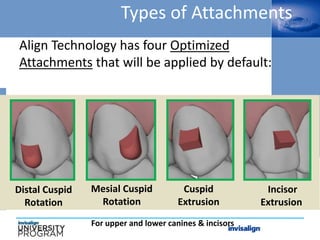 Types of Attachments
Align Technology has four Optimized
Attachments that will be applied by default:
Cuspid
Extrusion
Mesial Cuspid
Rotation
Incisor
Extrusion
Distal Cuspid
Rotation
For upper and lower canines & incisors
 