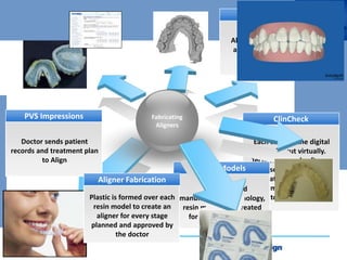 Aligners are sent to the
doctor office
Aligner Delivery
Fabricating
Aligners
Doctor sends patient
records and treatment plan
to Align
PVS Impressions
Align scans impressions
and creates 3 D digital
models
3D Model
Each tooth in the digital
model is cut virtually.
Technicians and software
stage serial movement to
create simulation of
treatment according to
doctor's instructions
ClinCheck
Using advanced
manufacturing technology,
resin models are created
for each virtual stage
Resin Models
Plastic is formed over each
resin model to create an
aligner for every stage
planned and approved by
the doctor
Aligner Fabrication
 