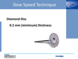 Slow Speed Technique
Diamond Disc
0.2 mm (minimum) thickness
 
