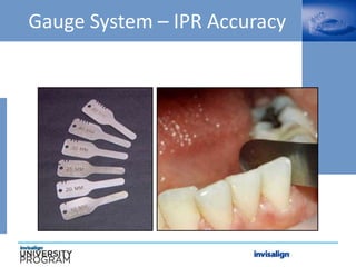 Gauge System – IPR Accuracy
 