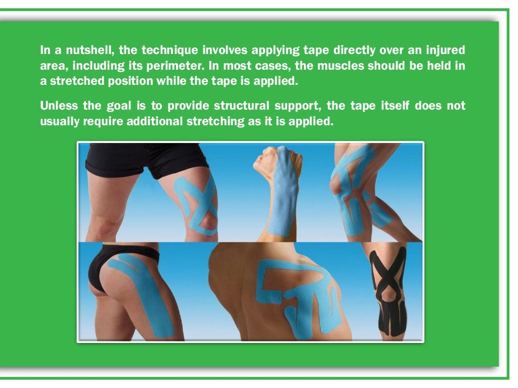 WHAT IS KINESIO TAPE AND WHY DO PHYSICAL THERAPISTS USE IT?
