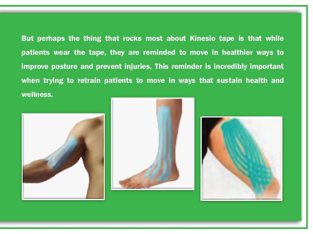 WHAT IS KINESIO TAPE AND WHY DO PHYSICAL THERAPISTS USE IT?