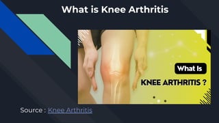 What is Knee Arthritis
Source : Knee Arthritis
 