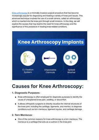 Knee arthroscopy is a minimally invasive surgical procedure that has become
increasingly popular for diagnosing and treating a variety of knee joint issues. This
advanced technique involves the use of a small camera, called an arthroscope,
which is inserted into the knee joint through small incisions. In this blog, we will
explore the causes that may lead to the need for knee arthroscopy and the
signiﬁcance of this procedure in treating knee-related conditions.
Causes for Knee Arthroscopy:
1. Diagnostic Purposes:
■ Knee arthroscopy is often employed for diagnostic purposes to identify the
cause of unexplained knee pain, swelling, or discomfort.
■ It allows orthopedic surgeons to directly visualize the internal structures of
the knee joint, including the cartilage, ligaments, and menisci, to diagnose
conditions such as torn meniscus, ligament injuries, and cartilage damage.
2. Torn Meniscus:
■ One of the common reasons for knee arthroscopy is a torn meniscus. The
meniscus is a cartilage that acts as a cushion in the knee joint.
 
