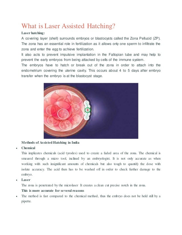 What is laser assisted hatching